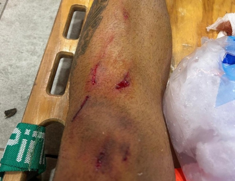 Nueve partidos de suspensi�n para un jugador de Loma Negra